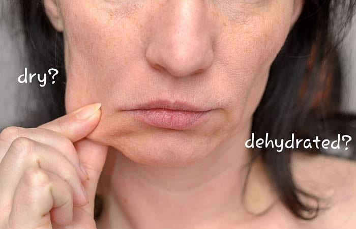 Dry or Dehydrated skin ??