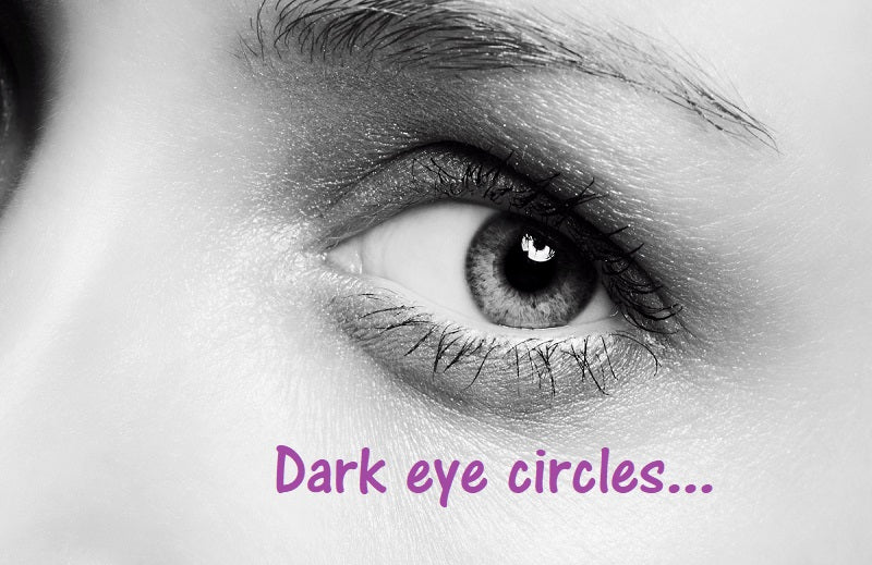 Dark Eye Circles......