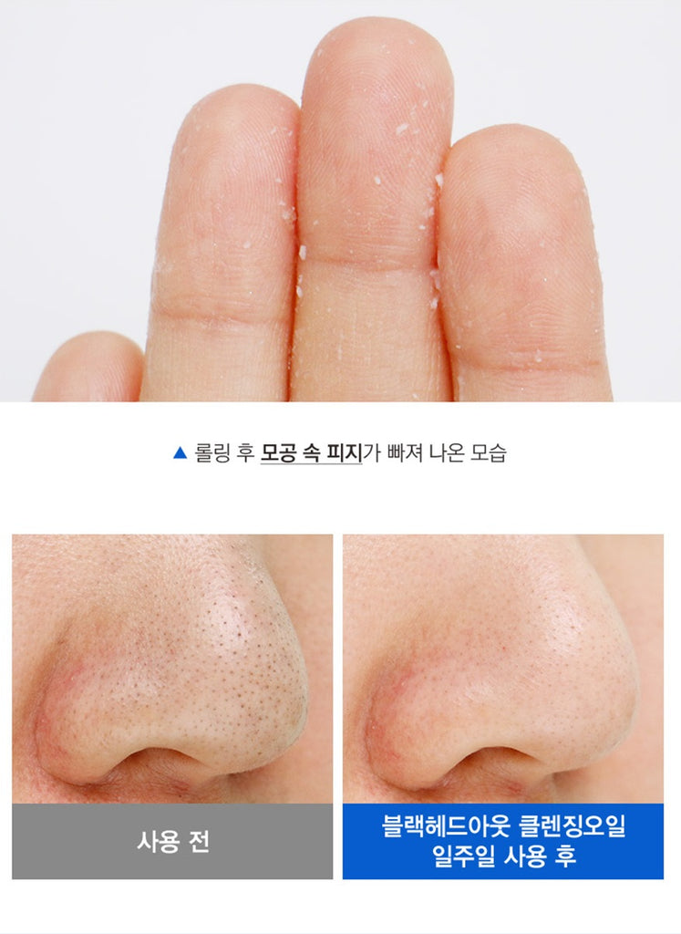 < NEW ARRIVAL > Tosowoong AHA Blackhead Out Cleansing Oil - 150ml